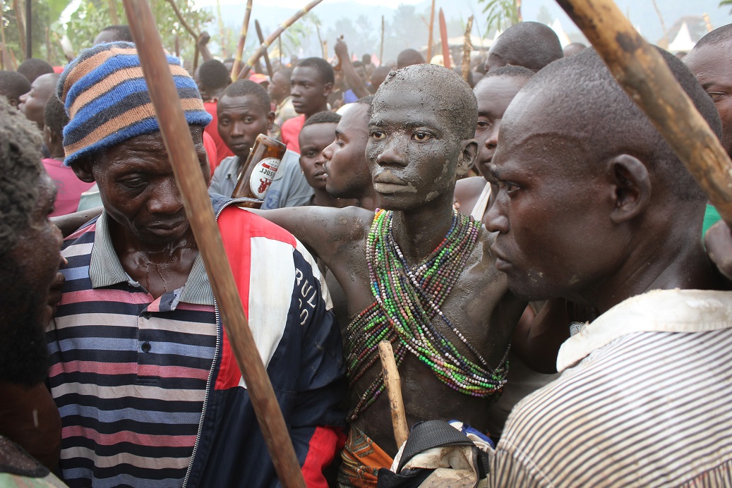 Gidudu keeps a straight face even after the local surgeons had finished the cut